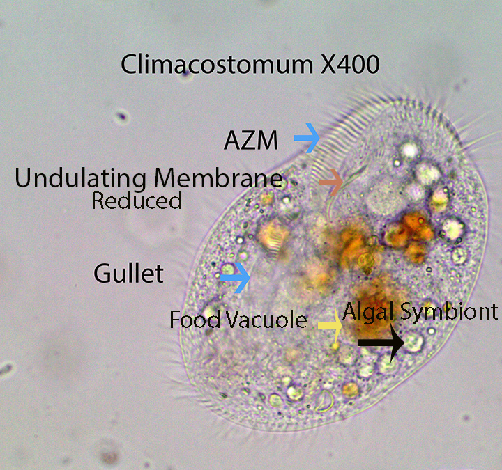 Ciliate Climacostomum  spp.jpg