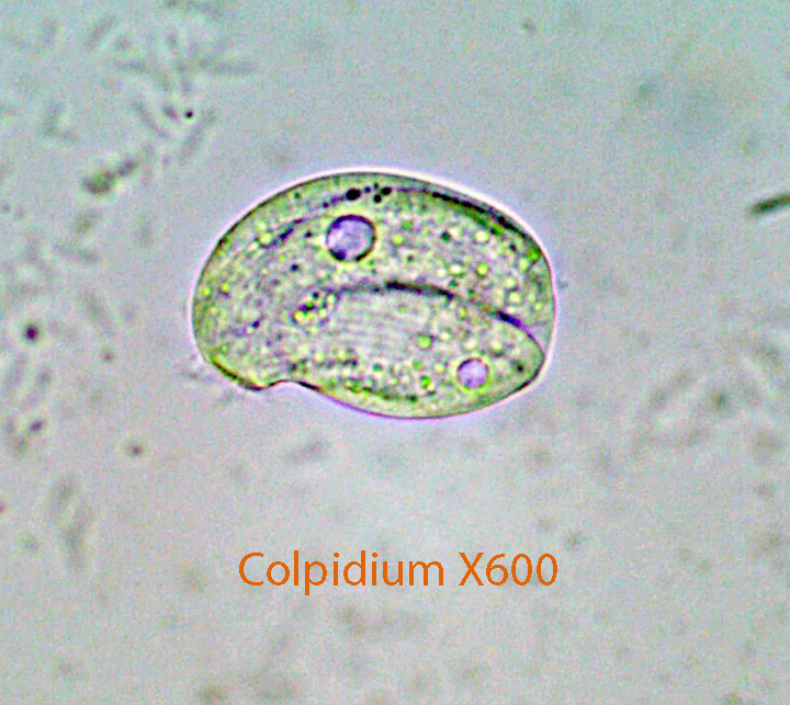 spirostomum under microscope 400x