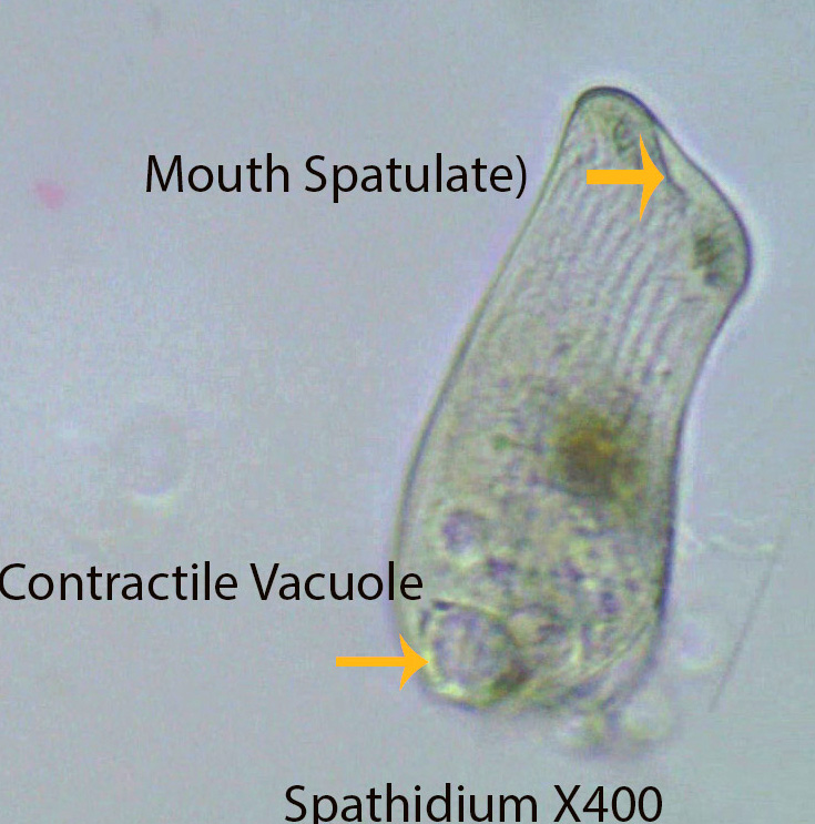 Ciliate  Spathidium spp.jpg