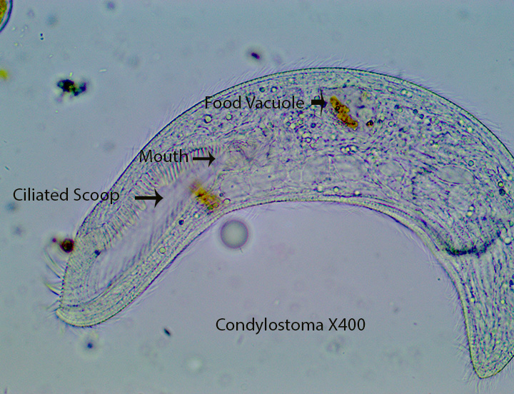 Ciliate Condylostoma X600 TP Marsh Lower Marshpool 9 27 2015 (5)