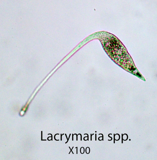 Ciliate Lacrymaria spp