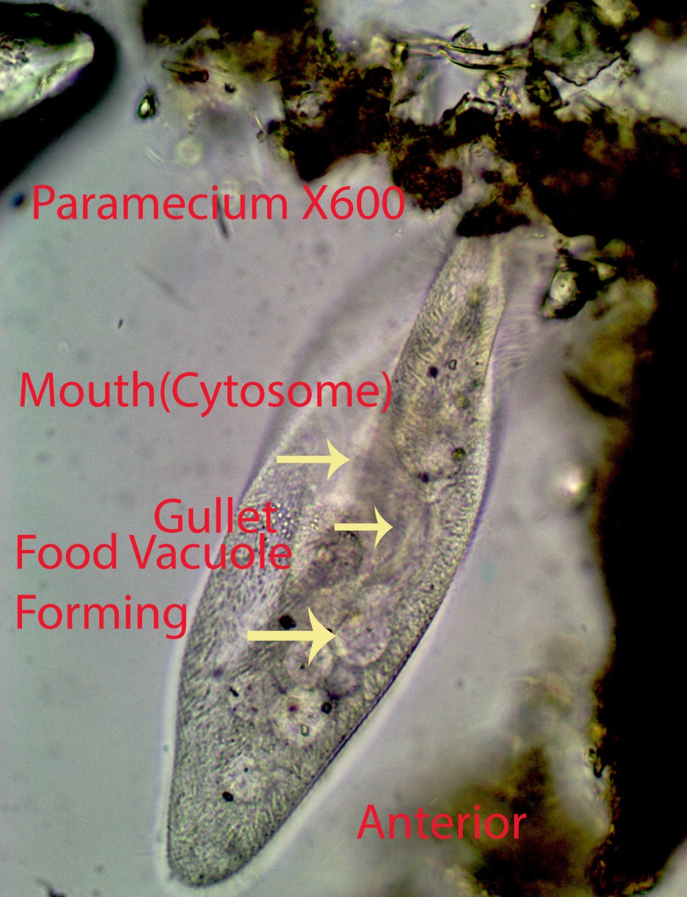 Ciliate Paramecium spp