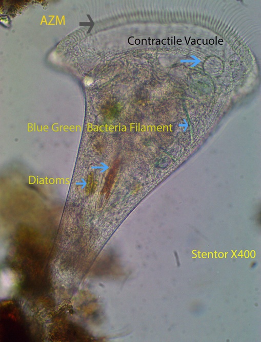 Ciliate Stentor spp
