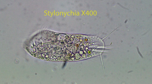 Ciliate Stylonychia spp