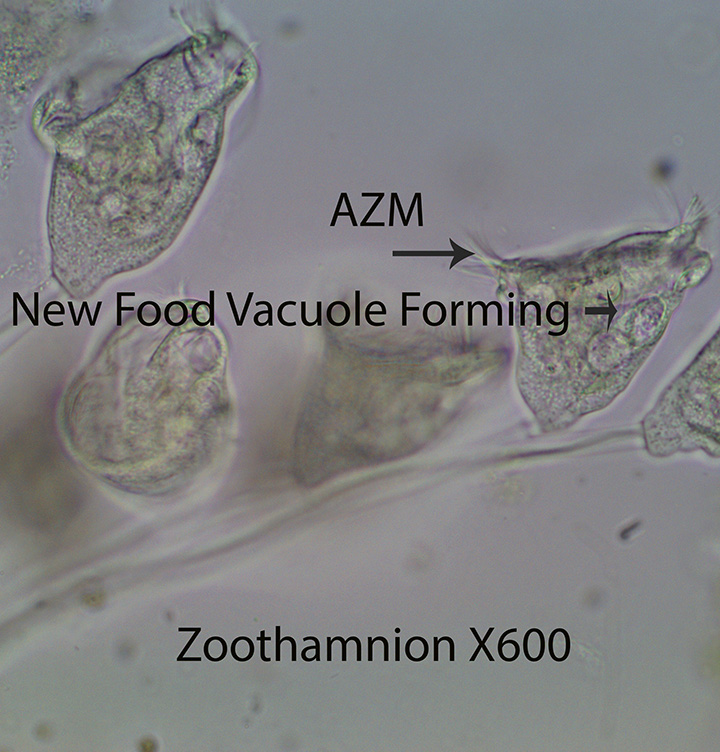 Ciliate Zoothamnion spp
