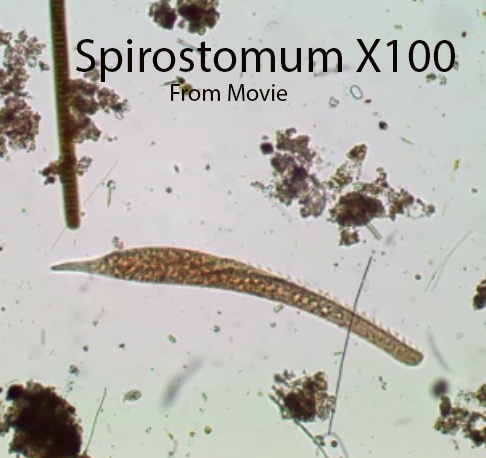 Spirostomum X100